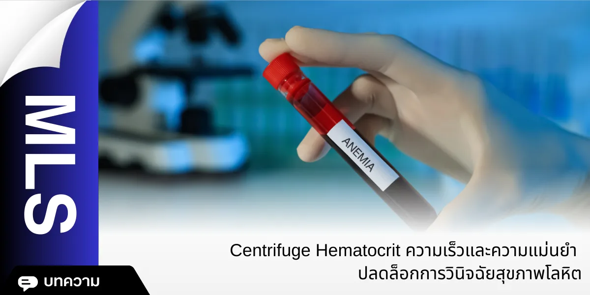 Centrifuge Hematocrit
